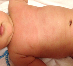 見た目に反して、痒がる素振りはない